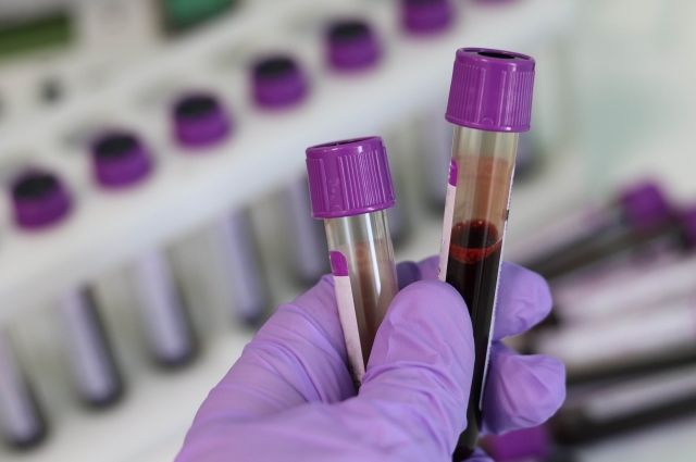 Число новых зараженных коронавирусом на Алтае упало ниже 100