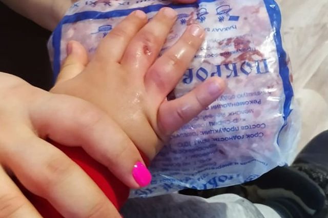 В Оренбурге спасатели помогли извлечь застрявшую руку трехлетнего мальчика