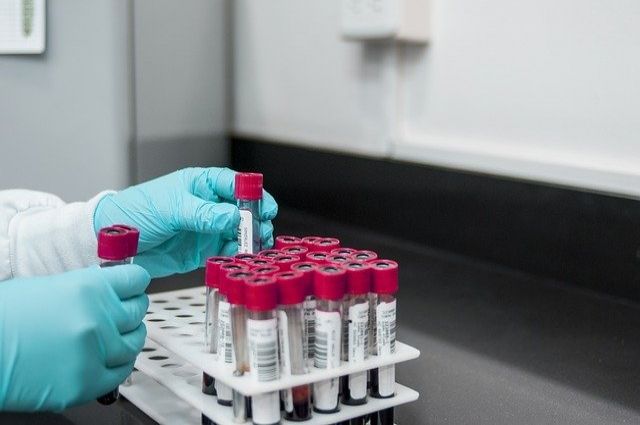 В Смоленской области провели 386 675 тестов на коронавирус