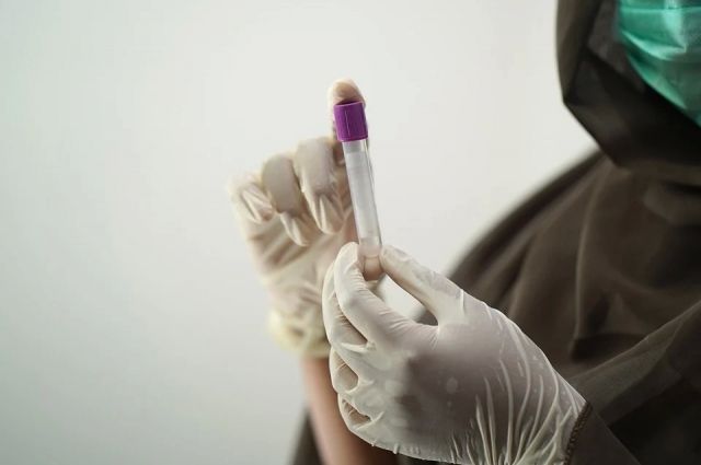 В Орловской области еще 54 человека заболели коронавирусом