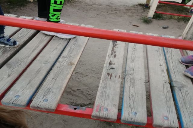 В Копейске двухлетняя девочка получила травму на ветхой игровой площадке