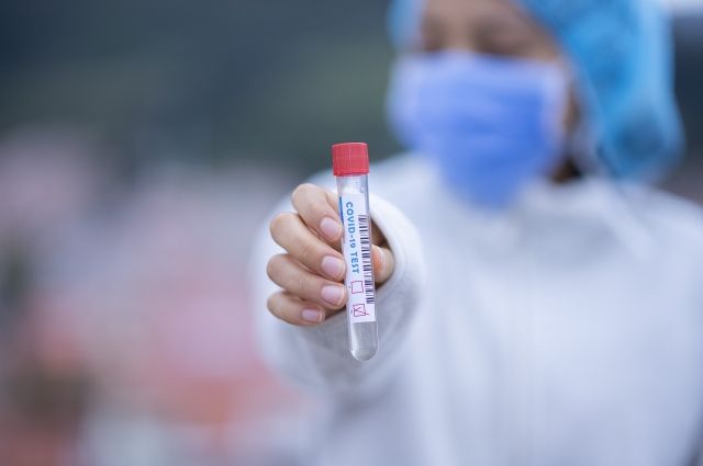 За последние сутки у 46 рязанцев диагностирован коронавирус