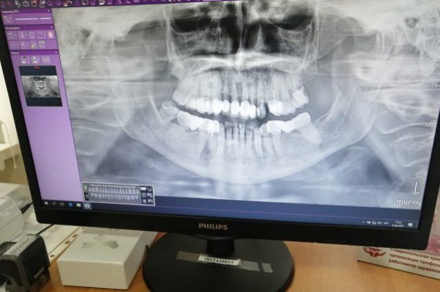 Городская стоматология Невинномысска обзавелась 3D томографом