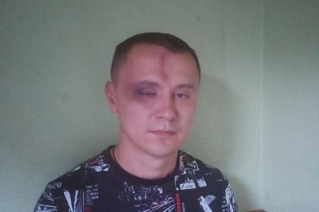 Дружинника в Новосибирске жестоко избила толпа незнакомцев