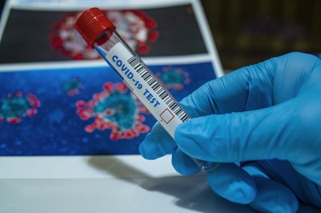 За сутки в Крыму коронавирусом заразились 379 человек