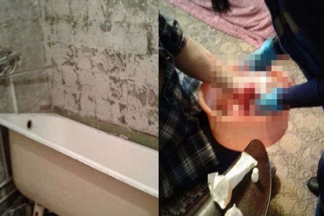 Житель Новосибирска раздавил руку чугунной ванной