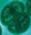 Бактерия Deinococcus radiodurans. Широко известна своей высокой устойчивостью к действию радиации, являясь одним из самых устойчивых к действию радиации организмов в мире. D. radiodurans способен выживать при дозе до 10000 греев
