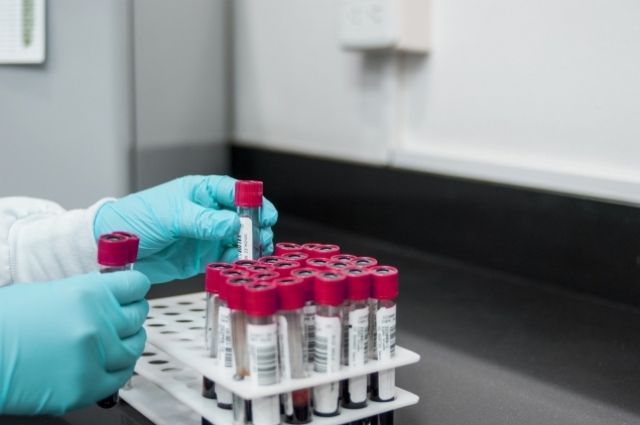 За сутки в Брянской области провели 3240 тестов на коронавирусную инфекцию