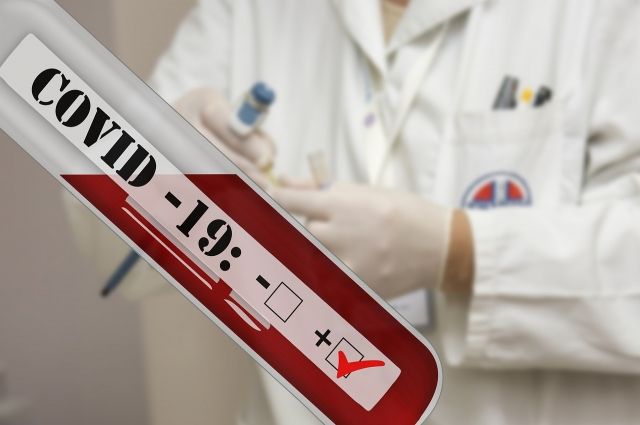 Еще 158 человек заболели COVID-19 в Сахалинской области