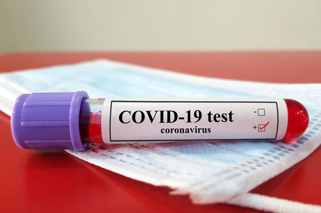 В Минцифры рассказали, как оформить COVID-сертификат по результату теста на антитела