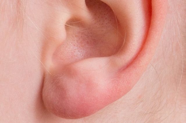 Специалисты ждут желающих с 1 по 5 марта.