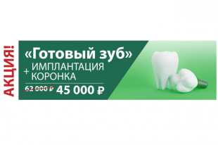 *количество имплантов по акции ограничено.