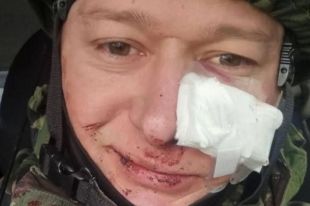 Лидер группы «Бумбокс» Андрей Хлывнюк получил ранение
