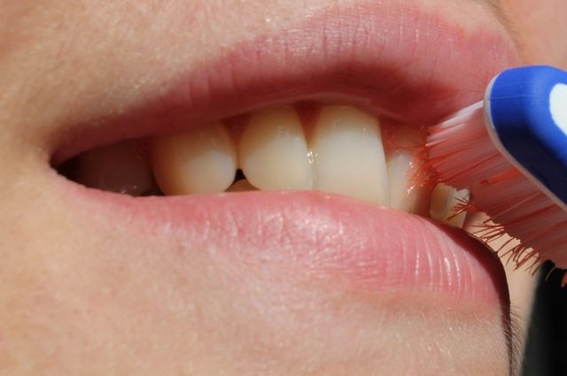 В Минздраве УР рассказали о пугающих последствиях коронавируса для зубов