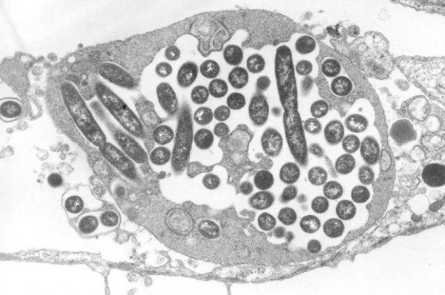 Клетки легионелл размножаются в культивируемых фибробластах легкого человека.