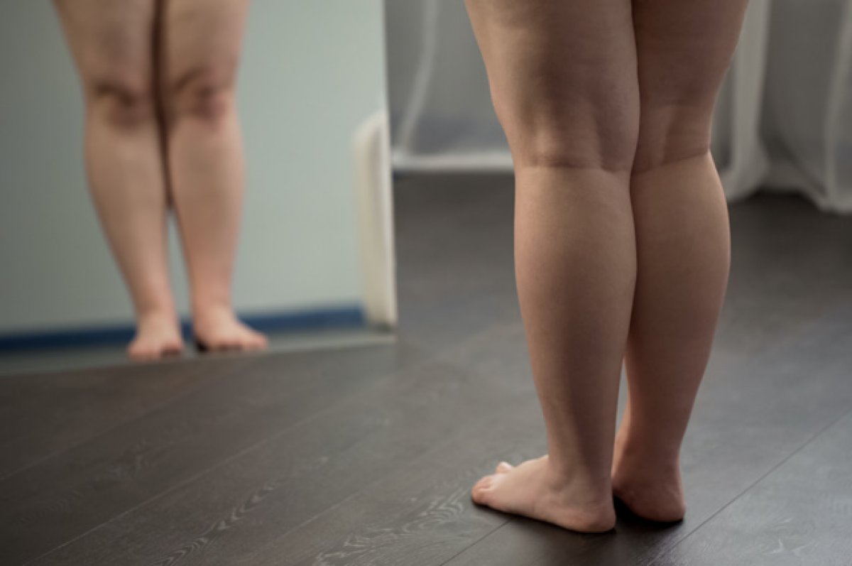 Ноги у толстых людей