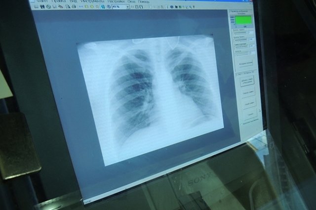 У двух оренбуржцев выявили опасную форму туберкулеза