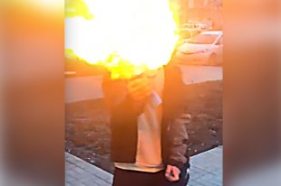 Мальчик поджигал струю от дезодоранта, направляя пламя в лицо.