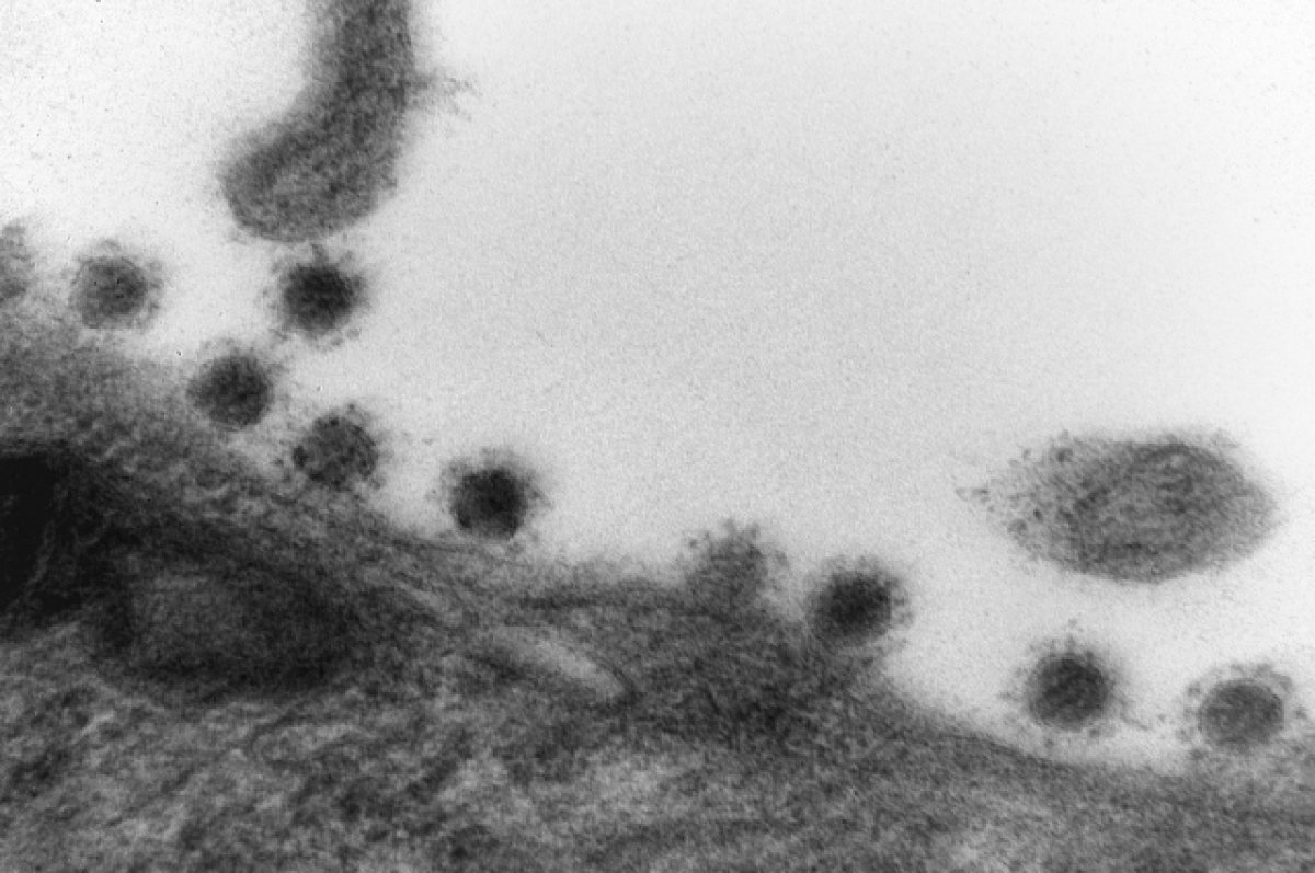 Роспотребнадзор: ущерб РФ от пандемии коронавируса почти 1,6 трлн рублей