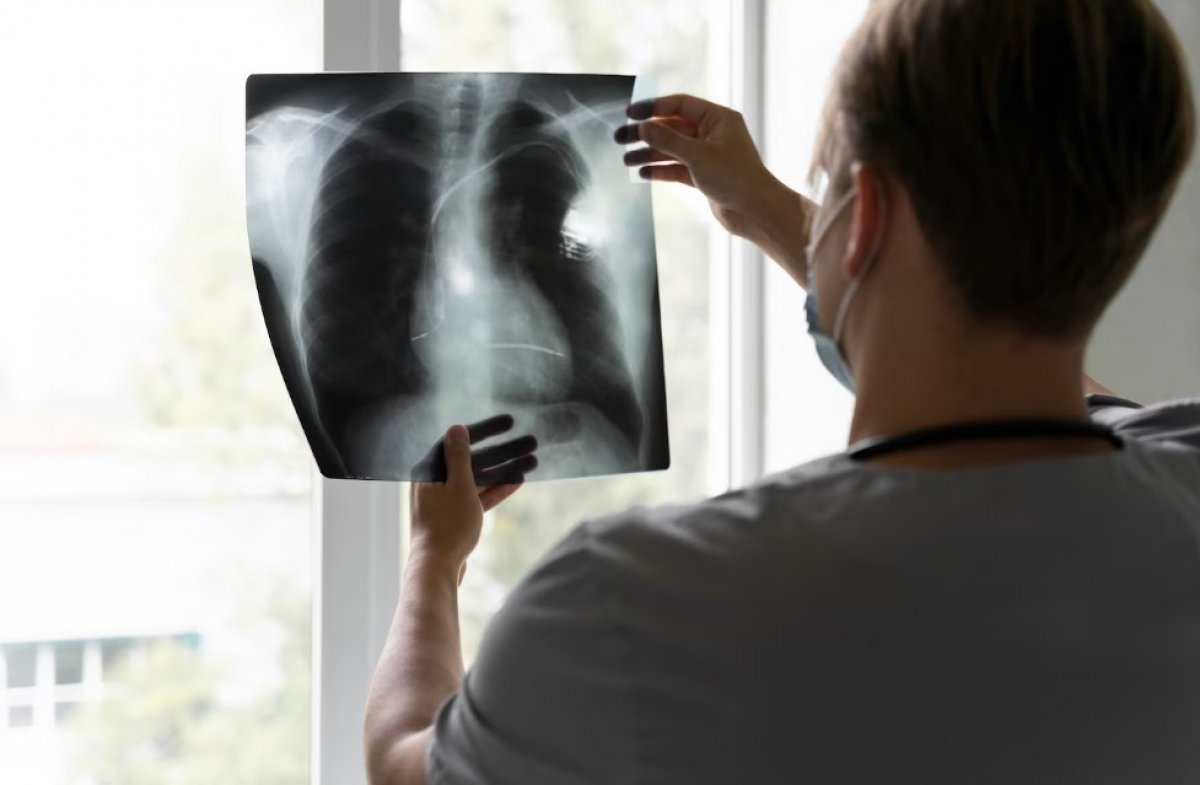 Донской регион стал одним из лидеров по росту заболеваний туберкулёзом