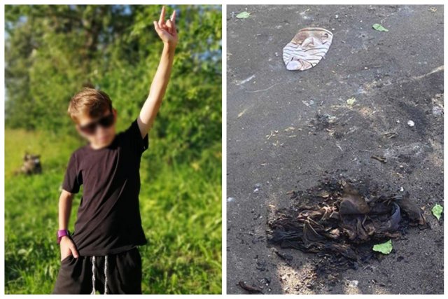 В Москве умер 14-летний подросток Артур, которого облили бензином и подожгли друзья.