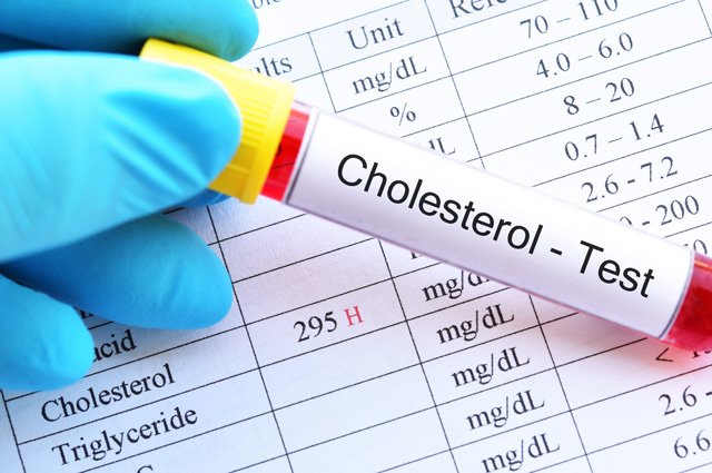 С какого возраста нужно начинать сдавать кровь на холестерин?