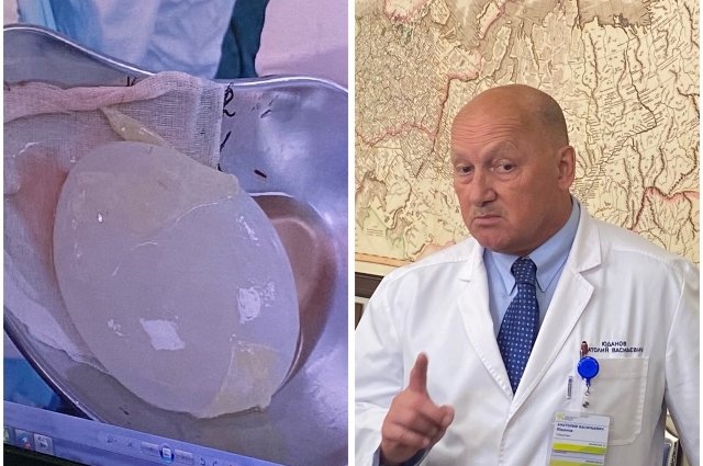 Новосибирские врачи удалили из головного мозга 5-летней девочки кисту.
