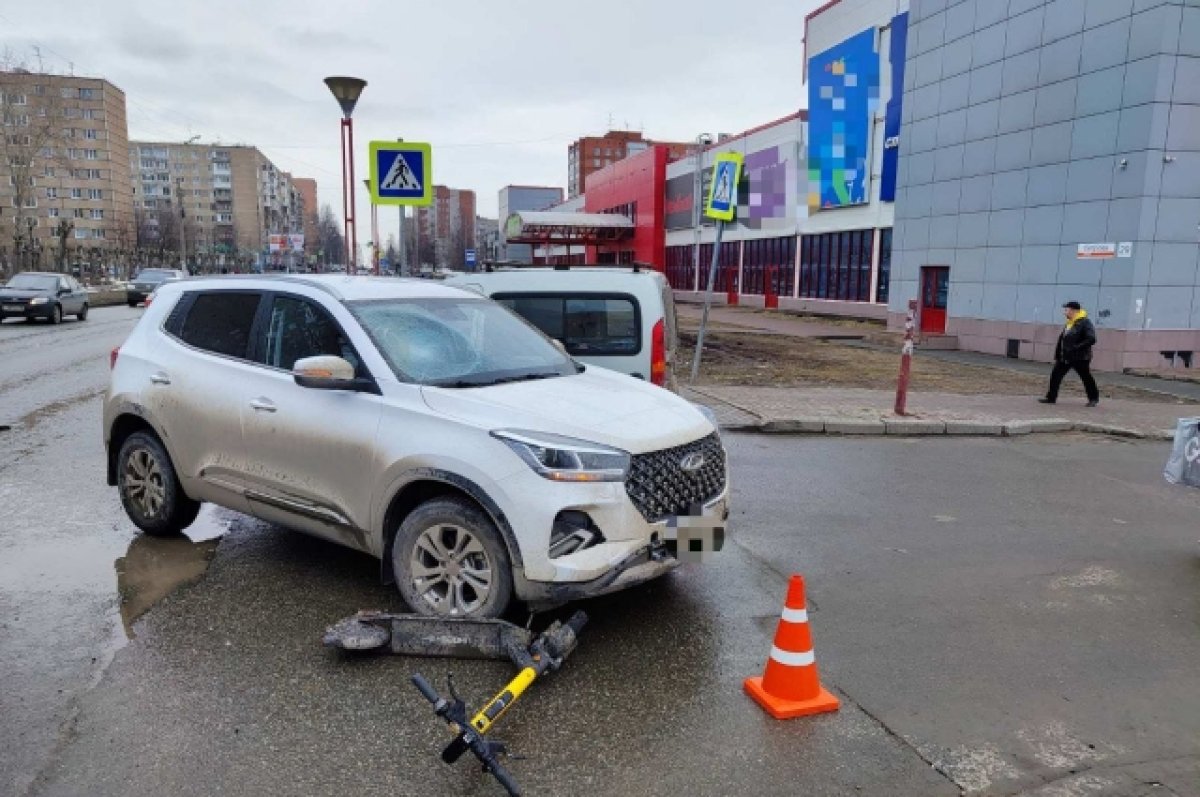 В Ижевске мужчина на электросамокате получил травмы в ДТП с автомобилем |  АиФ Удмуртия