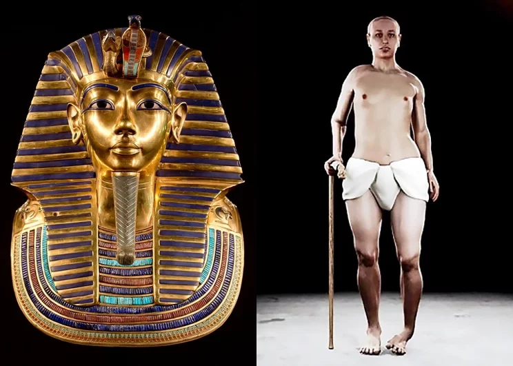 Тутанхамон, как выяснилось, страдал множеством серьезных заболеваний. У него были хрупкие кости и волчья пасть. Левая стопа была подвернута - врожденный вывих. 
