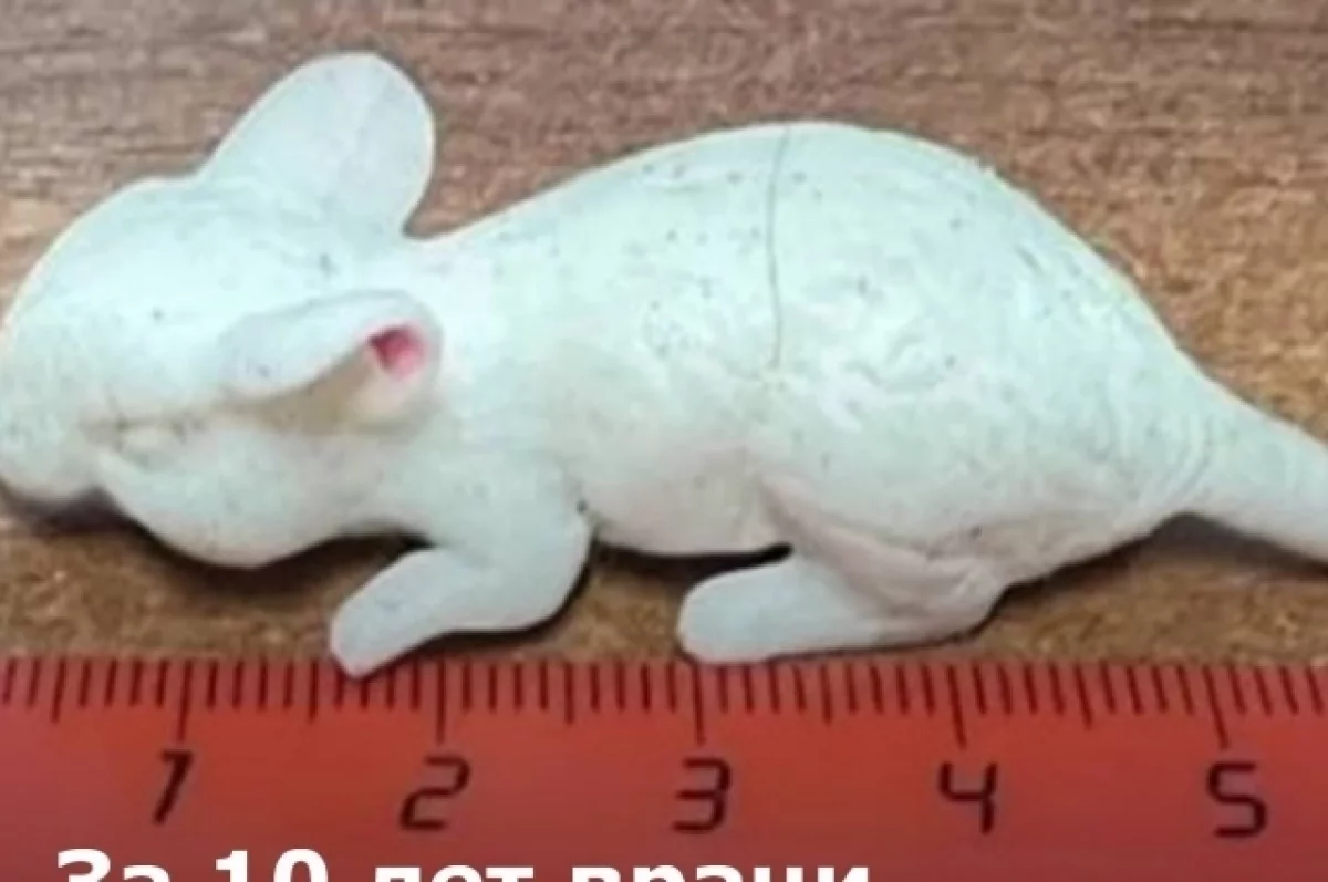 В Ростове врачи извлекли из пациентов набор фломастеров и мышь