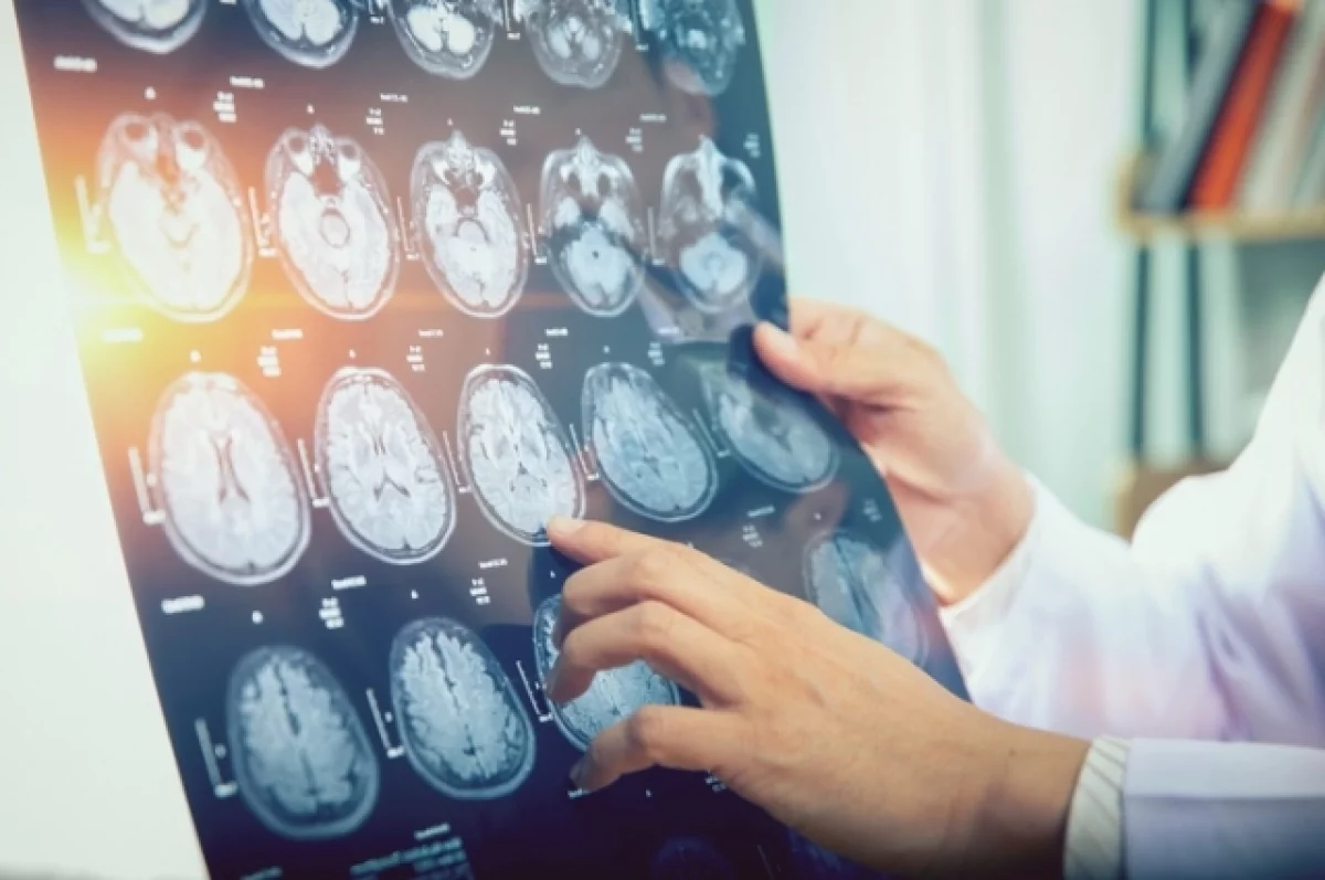 Невролог Шаймарданов назвал пять малоизвестных симптомов инсульта