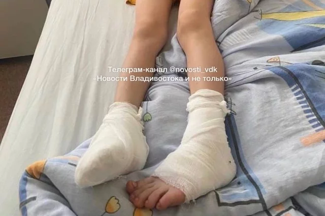 Мальчик случайно наступил на неогражденную кучу песка, которая оказалась очень горячей