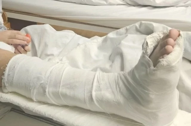 Ангелина получила тяжелый тройной перелом правой лодыжки со смещением, осложненный вывихом стопы