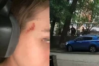 Одного из парней на Военведе избили до потери сознания.