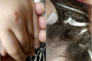 В городе Болотное Новосибирской области 7-летнюю школьницу избила ее же сверстница. В итоге у девочки обнаружили сотрясение головного мозга.