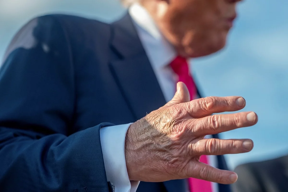 Больные вены и простой синяк? Врач Воробьев поставил Трампу другой диагноз