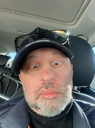 Козмопулос утверждал, что смог «договориться» со своей болезнью.