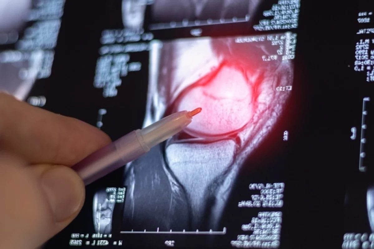 
        Вымывают кальций. Четыре напитка, которые разрушают суставы    