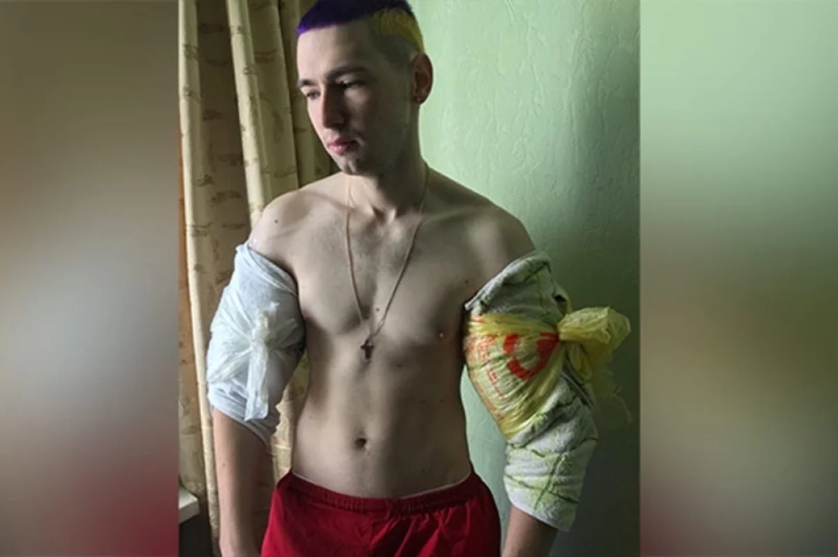 Цена славы без мозгов. Кирилл «Руки-базуки» потерял свои «мышцы мечты»
Цена славы без мозгов. Кирилл «Руки-базуки» потерял свои «мышцы мечты»