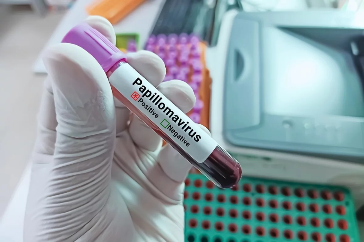 Коварный вирус. Что такое ВПЧ, каких типов бывает и когда вызывает рак