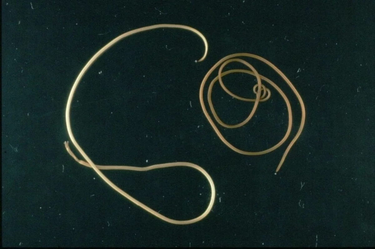 Паразитолог Лукашев сказал, как в глаз жительницы Омска попал живой червь