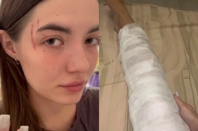 Девушки зафиксировали травмы в больнице.