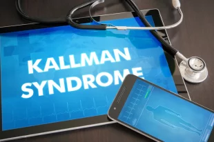 Что такое синдром Каллмана?