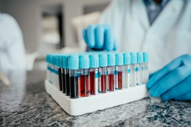 В Японии существует традиция «кецу-еки-гата» — жители Страны восходящего солнца уверены, что группа крови определяет склад личности и даже совместимость людей. На этом строят подбор персонала и дают рекомендации по обустройству личной жизни.