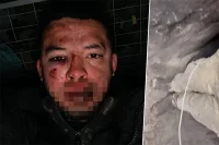 Камило Мело и цепь, на которой его держали. 