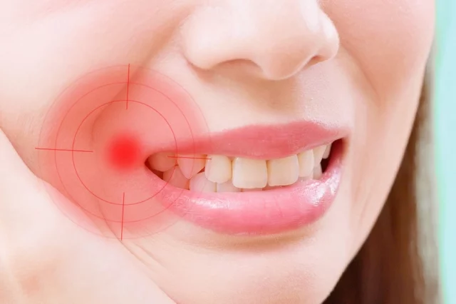 Пародонтит — проблема загадочная и недооцененная.