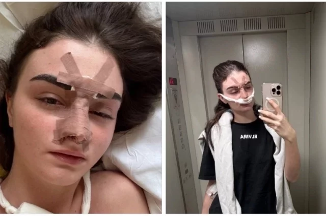 Фото из больницы пострадавшая разместила в своих Соцсетях