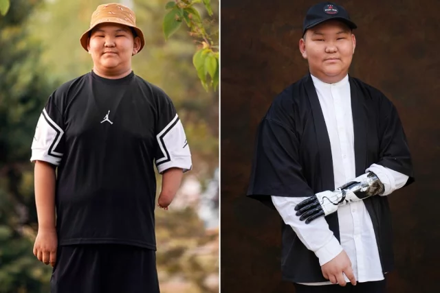 Парень наконец почув­ствовал, что с бионическим протезом может практически всё: и конструктор собирать, и с ножницами управляться.