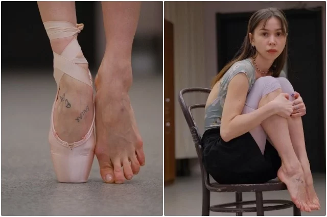 Ноги балерины часто страдают из-за активных нагрузок