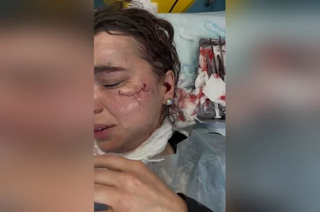 А через несколько часов оказалась на операционном столе с рассечённым до кости лицом. 